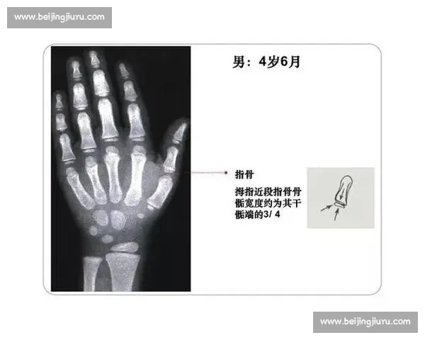 18 岁骨骺线未闭合?科学 3 招助你再长高 5cm 18 岁骨骺线未闭合?科学 3 招助你再长高 5cm