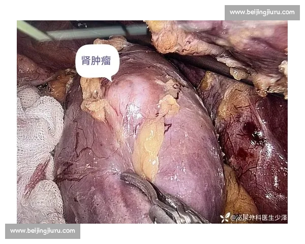 从肾癌病房到商业帝国:韦德如何用三重身份重塑人生 从肾癌病房到商业帝国:韦德如何用三重身份重塑人生